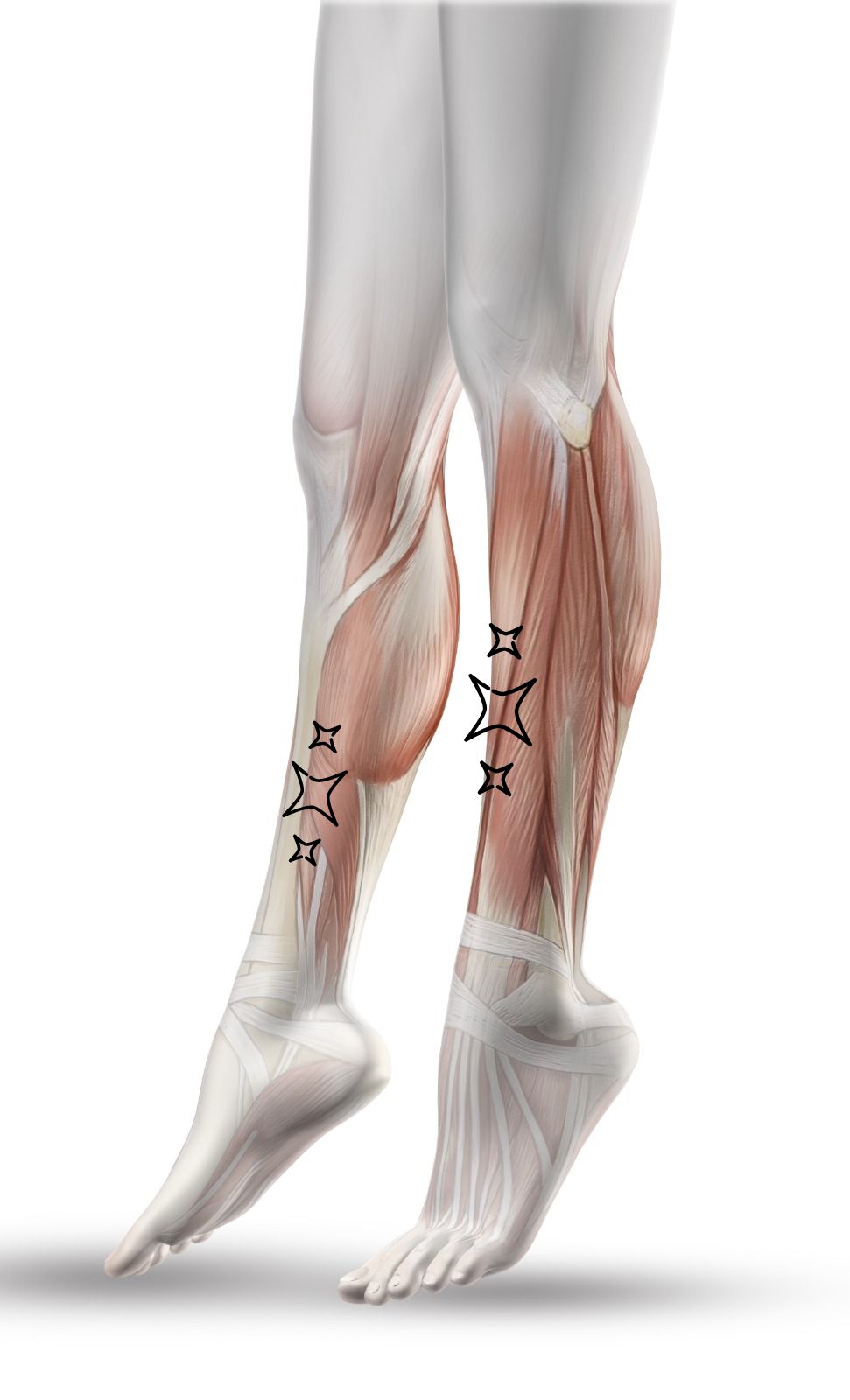 Effective Shin Splints Treatment