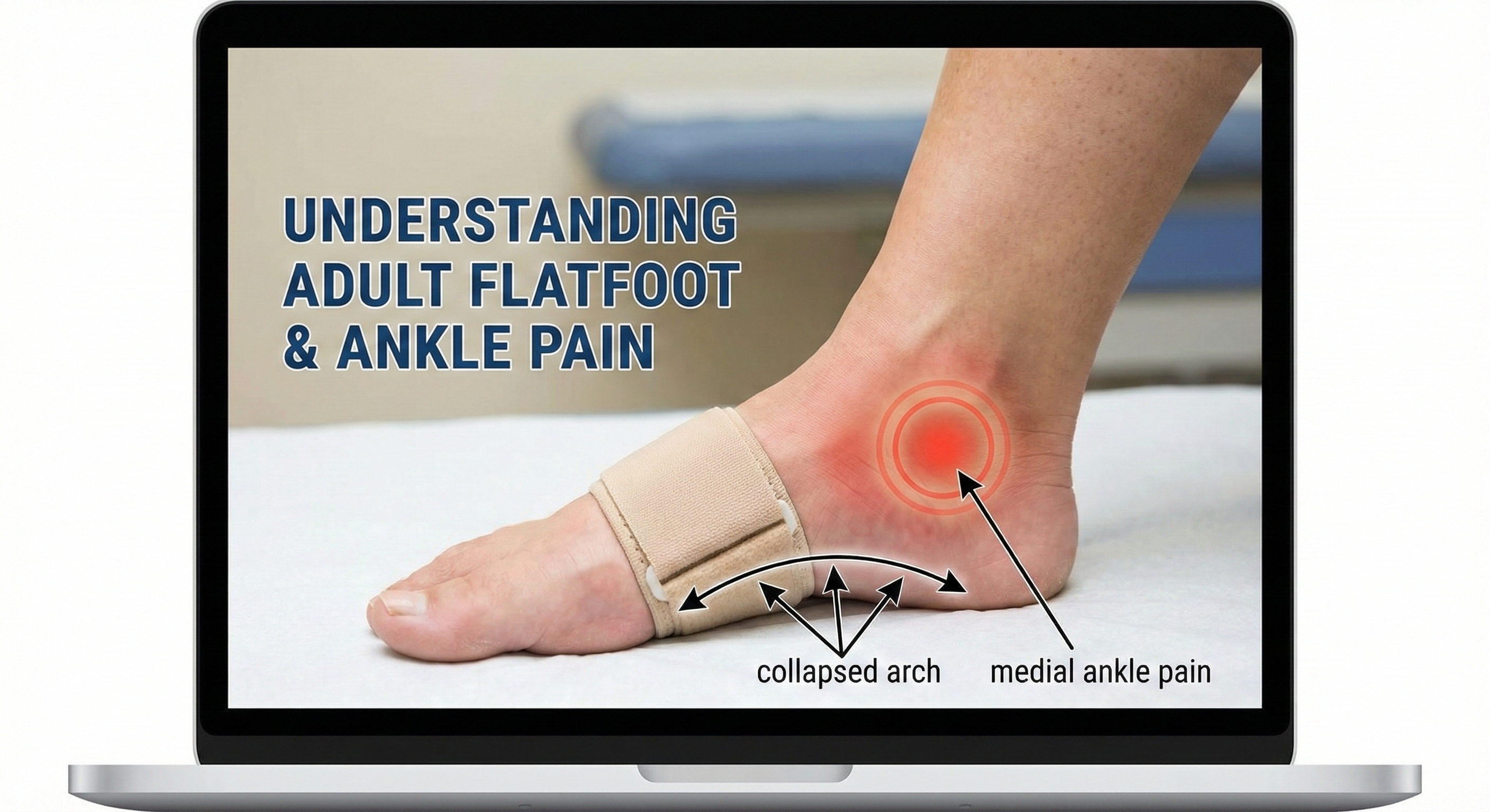 Why Does My Ankle Hurt?