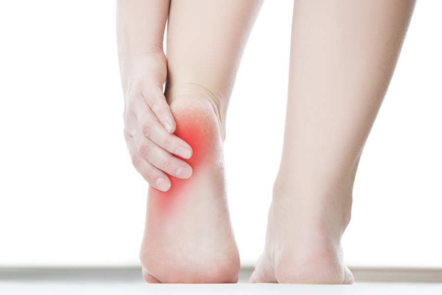 Understanding Plantar Fasciitis: Causes, Symptoms & Treatments