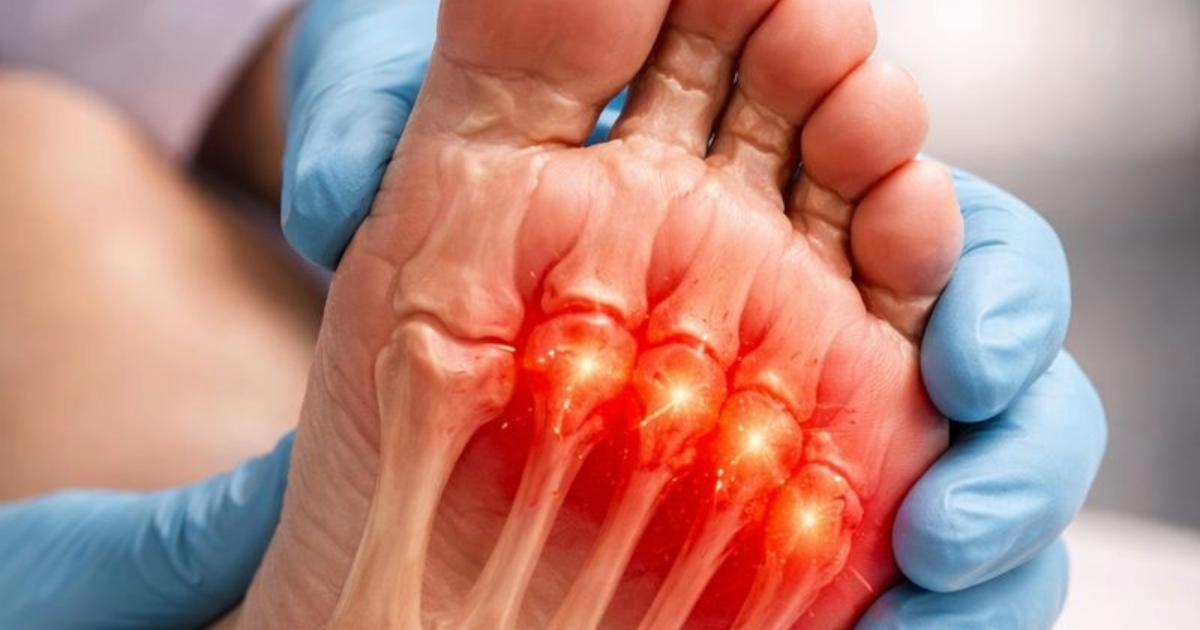 Foot Fat Pad Atrophy and Fat Pad Migration